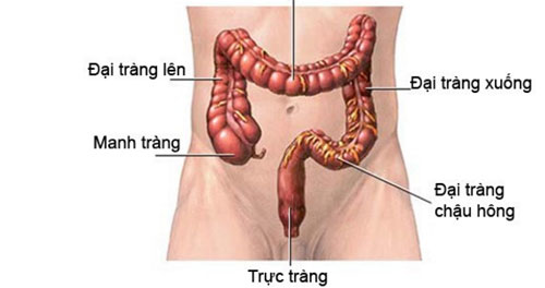 5 dấu hiệu sớm của bệnh ung thư trực tràng