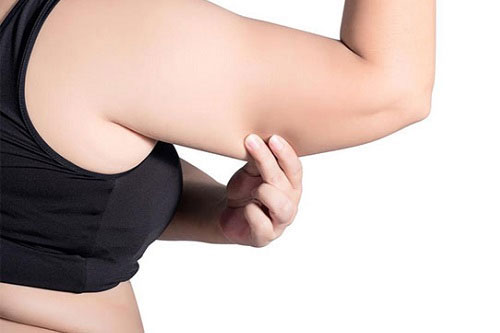 Giải quyết triệt để mỡ bắp tay tại nhà