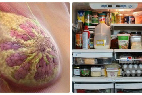 'Vạch mặt' thực phẩm hàng đầu gây ung thư vú có trong tủ lạnh của hầu hết mọi gia đình