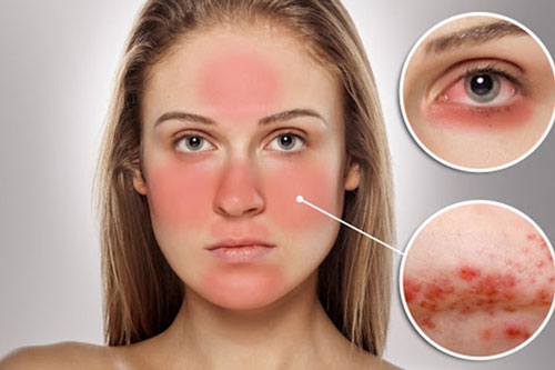 8 dấu hiệu của cơ thể chứng tỏ bạn cần thải độc ngay