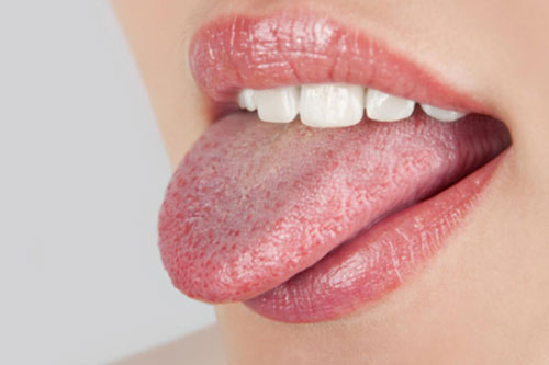 Đánh răng đều đặn mỗi ngày nhưng vẫn bị hôi miệng, nguyên nhân nằm ở một bộ phận ít ai ngờ