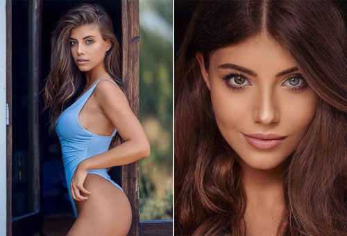 Tân Hoa hậu Ba Lan: Người đẹp hiếm hoi có đôi mắt tự nhiên mang 2 màu khác biệt