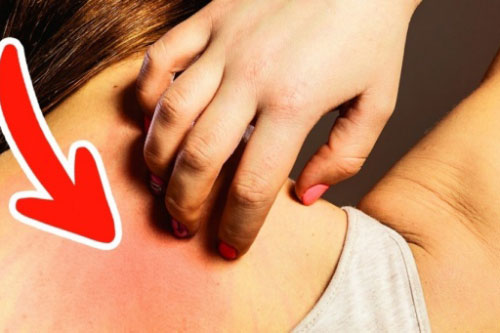 Đây chính là những dấu hiệu ung thư thời kỳ đầu mà hầu hết mọi người thường hay bỏ qua