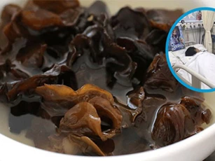 Ăn mộc nhĩ cần biết điều này, đừng dại mà mắc phải