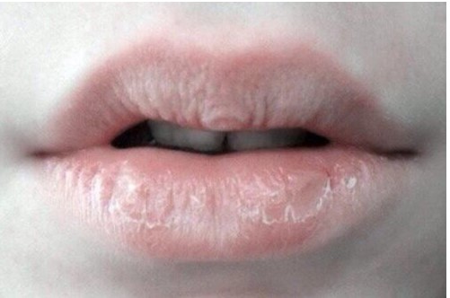 4 dấu hiệu trên khuôn mặt cảnh báo gan của bạn đang "kêu cứu"