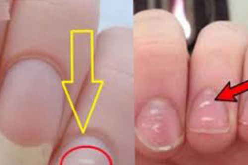 3 thứ hồng hào chứng tỏ bạn sống thọ, 3 bộ phận thâm đen là dấu hiệu đoản thọ cần đi khám gấp