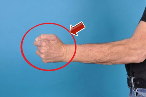 Hạ cao huyết áp "cấp tốc"- mất 10 phút mà cứu cả một đời người