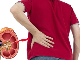 Dấu hiệu "rõ mồn một" bạn đang bị sỏi thận, đừng bỏ qua