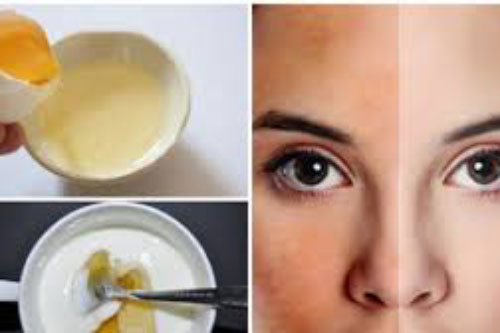 Trộn lòng trắng trứng với thứ này thoa lên mặt, làn da xỉn màu khô ráp bỗng bật tông trắng sáng bất ngờ