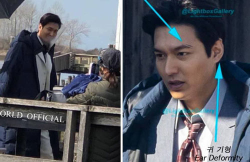 Ảnh chụp vội cho thấy sự thay đổi về diện mạo, Lee Min Ho lộ bằng chứng phẫu thuật thẩm mỹ?