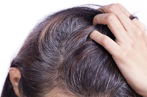 4 giải pháp hàng đầu ngăn ngừa tóc bạc sớm