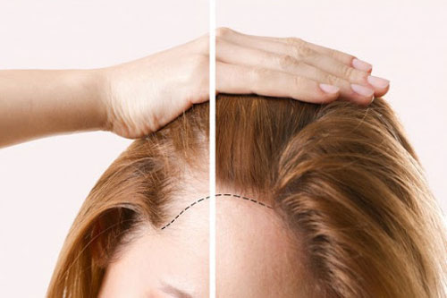 Mẹo giúp tóc mỏng trở nên dày chỉ trong tức khắc