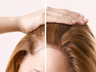 Mẹo giúp tóc mỏng trở nên dày chỉ trong tức khắc