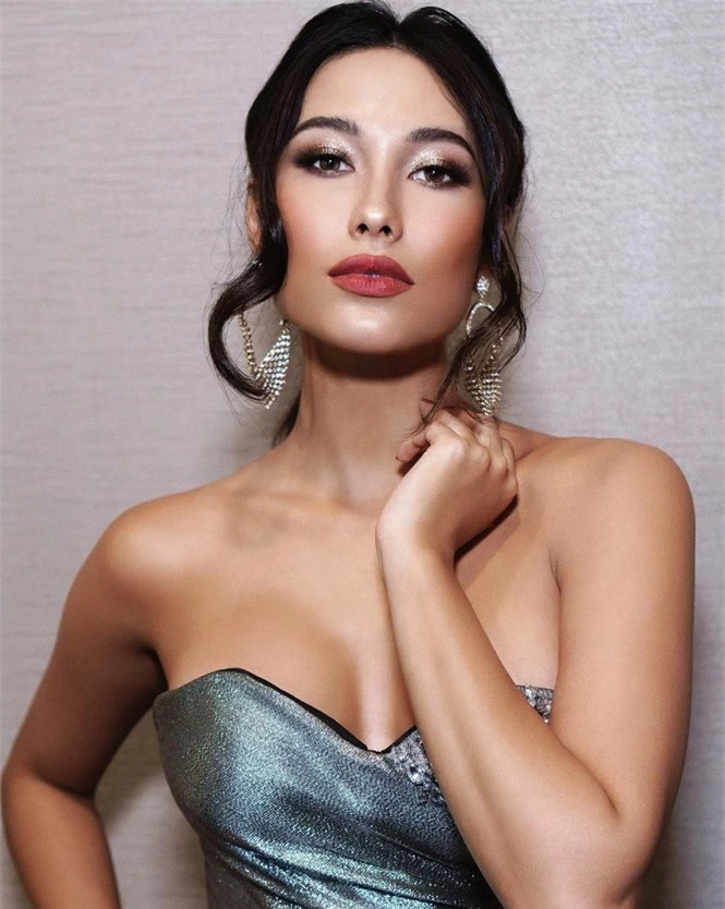 Hoa hậu Hoàn vũ Indonesia khổ sở vì bỏng mặt hậu thẩm mỹ - ảnh 3