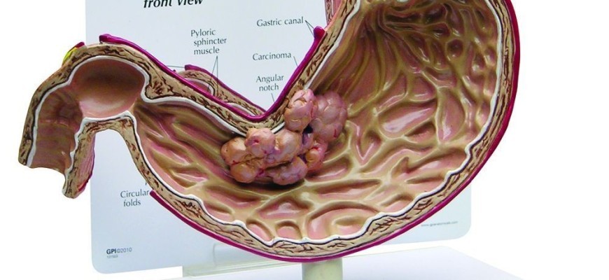 Khi thấy cơ thể có những dấu hiệu này, hãy đi khám ngay kẻo hối không kịp