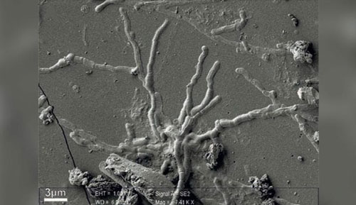 Phát hiện tế bào não còn nguyên vẹn sau 2.000 năm ở Italy