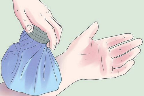 Con nghịch dại dẫn đến chân tay tím tái: Mẹ chỉ cần dùng 3 mẹo nhỏ sau, sẽ nhanh chóng đánh tan máu bầm