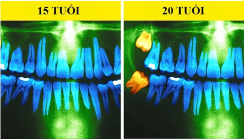 Cứ qua 10 năm, cơ thể bạn sẽ thay đổi như thế nào?