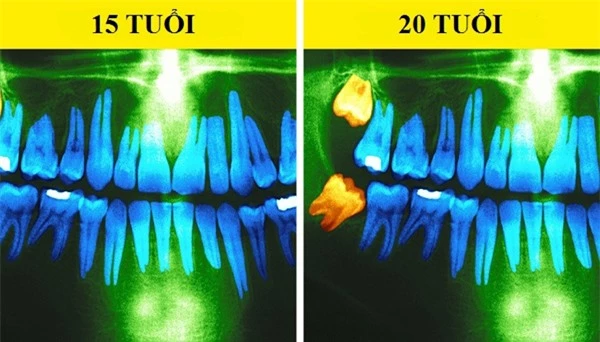 Cứ qua 10 năm, cơ thể bạn sẽ thay đổi như thế nào