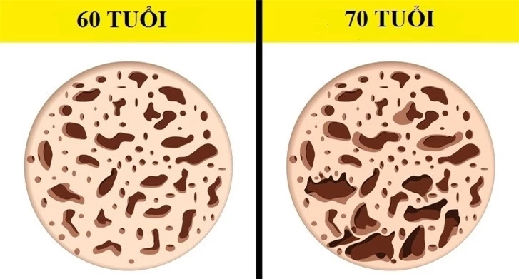 Cứ qua 10 năm, cơ thể bạn sẽ thay đổi như thế nào