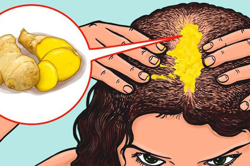 Mách chị em 3 bí kíp giúp chỗ hói mọc tóc cực nhanh chỉ với những nguyên liệu tự nhiên bếp nào cũng có