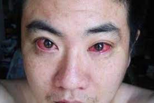 "Vạch mặt" sát thủ gây ung thư mà rất nhiều người vẫn tiếp xúc trước khi ngủ