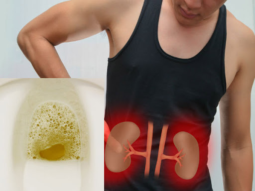 4 dấu hiệu cảnh báo suy thận bạn cần nắm rõ