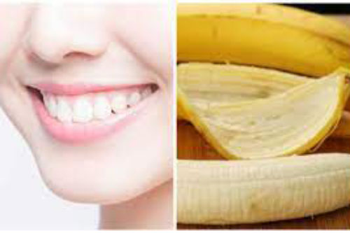 Ăn chuối đừng vội vứt vỏ, hãy làm điều này bạn sẽ thấy tác dụng kỳ diệu