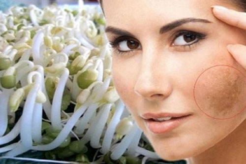 Giá đỗ - thực phẩm rẻ tiền nhưng mang đến cho cơ thể muôn vàng lợi ích nếu ăn theo cách này