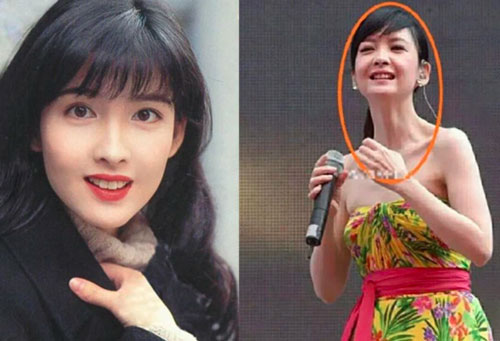 Đệ nhất ngọc nữ Châu Huệ Mẫn: Đi hát tỉnh lẻ bị ghẻ lạnh, lộ nhan sắc tàn phai, lưng gù