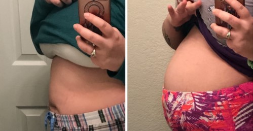 Một số dấu hiệu cảnh báo các vấn đề sức khỏe ở phụ nữ mà bạn nên biết