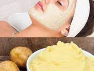 Phương pháp đắp mặt nạ khoai tây rẻ tiền giúp da trắng hồng