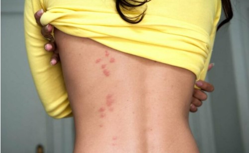 Top 8 dấu hiệu cảnh báo bạn đang bị stress nặng