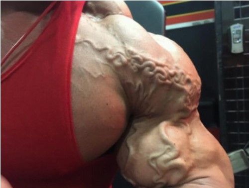 Cơ thể nổi gân xanh cảnh báo điều gì về sức khỏe của bạn?