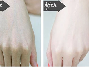 2 công thức làm trắng da tại nhà đơn giản nhất