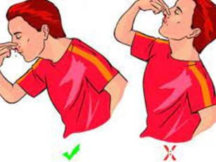 Không ngửa đầu ra phía sau, đây mới là cách xử lý khi bị chảy máu cam an toàn nhất