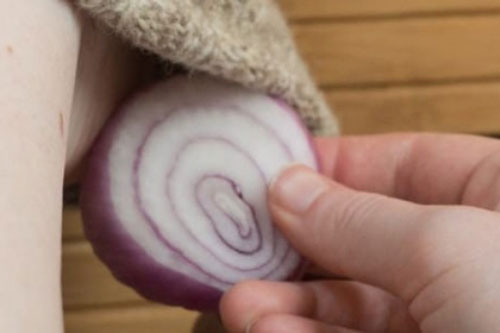 Đảm bảo hết hôi chân chỉ với lát hành tây