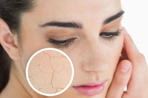 Dấu hiệu cơ thể đang thiếu vitamin C cần bổ sung ngay