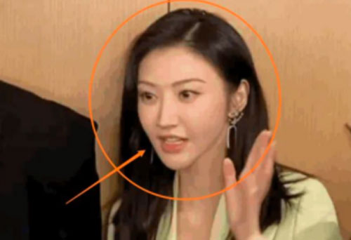 "Tư Đằng" Cảnh Điềm phẫu thuật thẩm mỹ để được giống Angelababy?