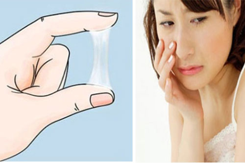 3 dấu hiệu cảnh báo bệnh phụ khoa nguy hiểm, có 1/3 cũng phải đi khám ngay lập tức