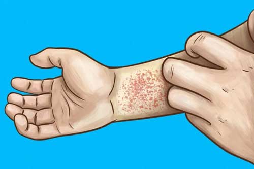 10 dấu hiệu cho thấy thận của bạn đang gặp vấn đề nghiêm trọng