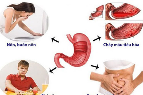 Những dấu hiệu cảnh báo đau dạ dày, rất nhiều người mắc bệnh mà không biết