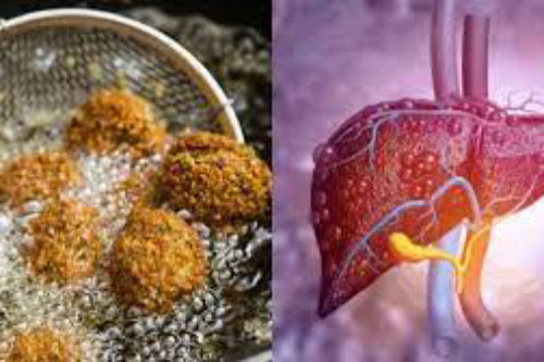 4 món ăn gây hại gan hàng đầu được WHO liệt vào "danh sách đen", người Việt vẫn vô tư ăn mỗi ngày