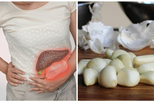 Tỏi rất tốt cho sức khỏe, nhưng chế biến với các thực phẩm sau là đại kỵ, "ủ bệnh" cho cả nhà