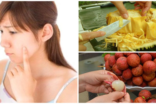 Những loại trái cây có tính nóng, càng ăn càng dễ nổi mụn