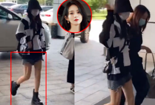 Không những lộ thân hình ngày càng gầy, Triệu Lệ Dĩnh còn bị soi đôi chân gân guốc và kém nuột nà