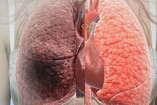 Thực phẩm thanh lọc phổi đặc biệt hiệu quả, dù với người hút thuốc lá nhiều năm