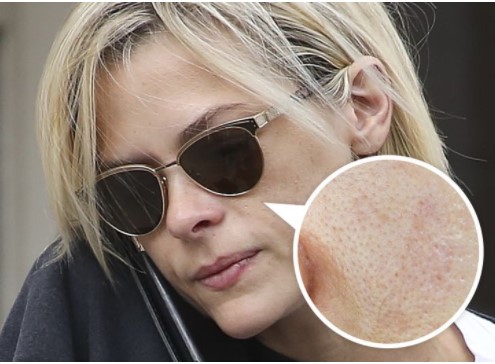 Điểm danh 7 thói quen xấu đang âm thầm 'giết chết' làn da của bạn