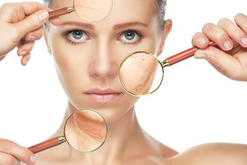 Da hỗn hợp cần có cách chăm sóc riêng