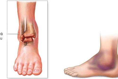 Nhìn xuống bàn chân thấy 3 điểm đầu tiên sức khỏe tốt sống thọ, 2 điểm sau cùng nhiều bệnh tật, dễ đoản mệnh